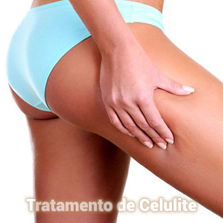Tratamento de Celulite Dermo Essence em Aracaju-SE